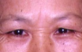 面相学,面相图解图片